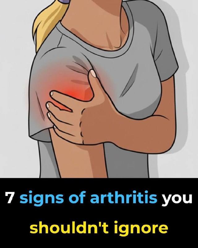 7 Signs of Arthritis You Shouldn’t Ignore