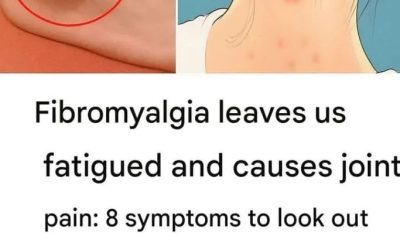 FIBROMYALGIA: The Disease of Unexpressed Emotions