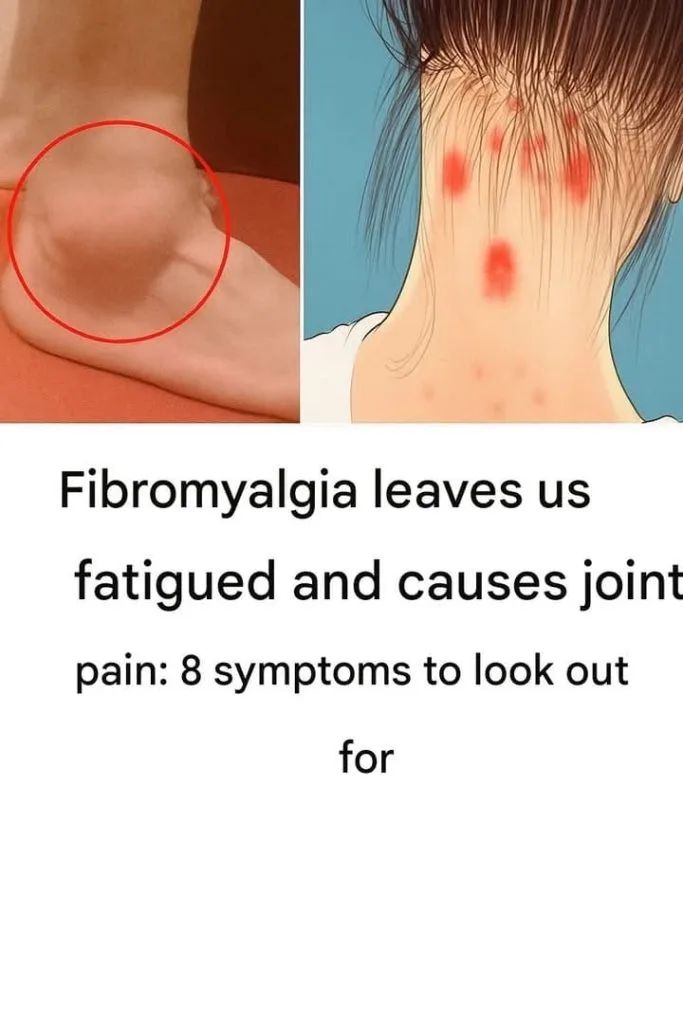 FIBROMYALGIA: The Disease of Unexpressed Emotions