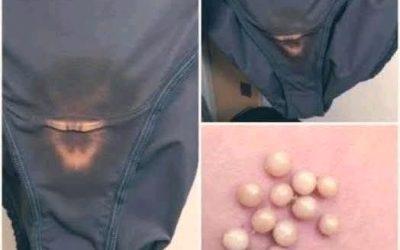 These stains on underwear aren’t normal discharge, they’re… See more