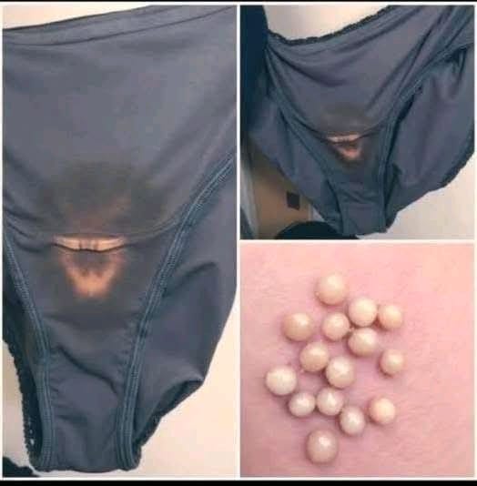 These stains on underwear aren’t normal discharge, they’re… See more
