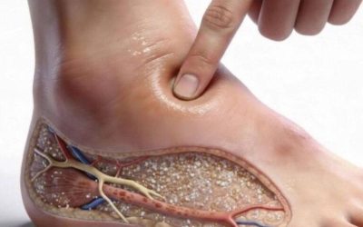 These are the consequences of sleeping with… see more