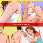 12 Warning Signs That Your Body Is Growing Cancer Cells