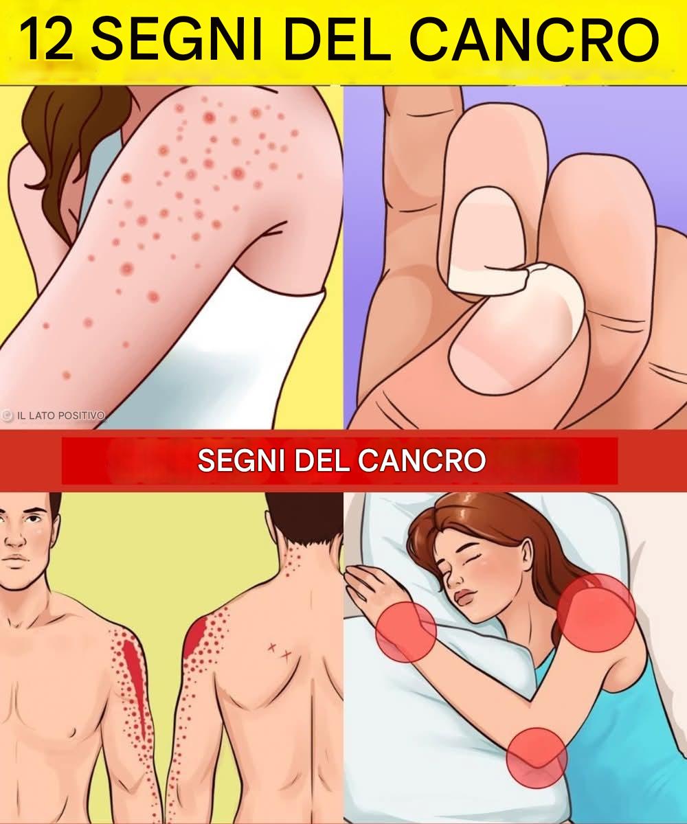 12 Warning Signs That Your Body Is Growing Cancer Cells