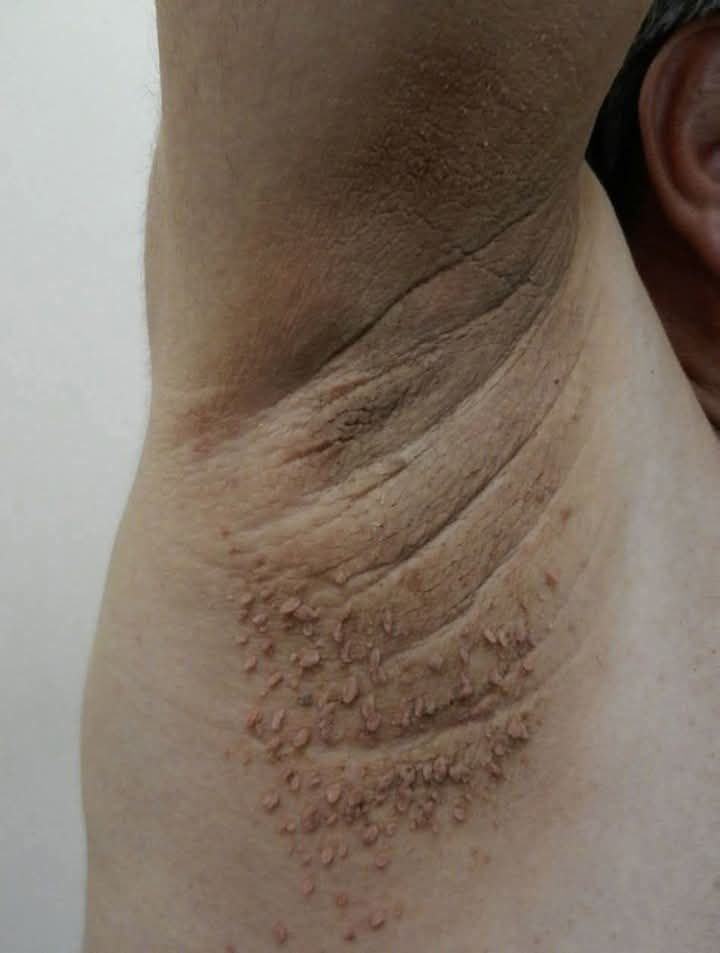 These are the first symptoms of cr…See more